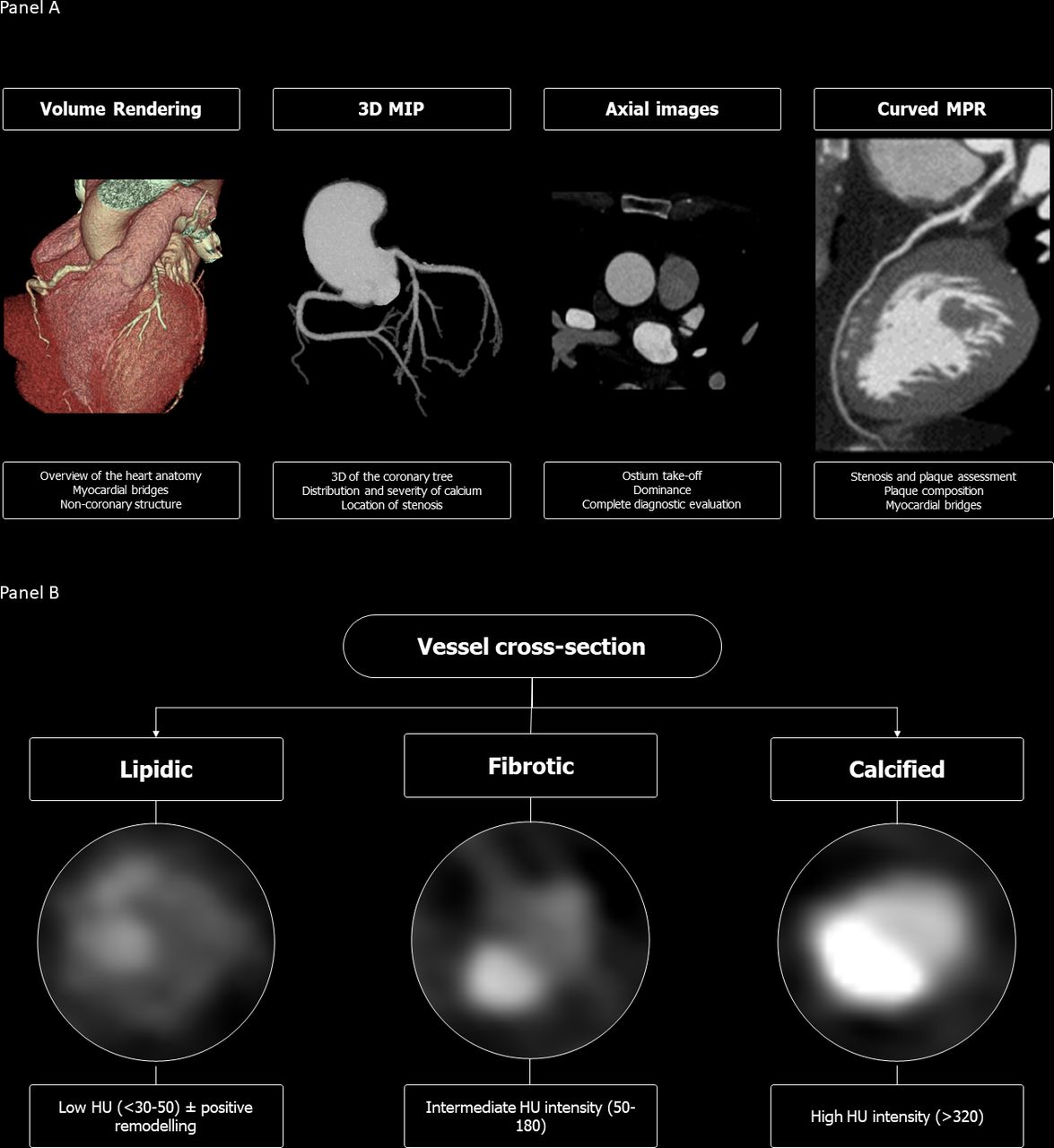 Atlas of FFR-Guided Percutaneous Coronary Interventions [ハード