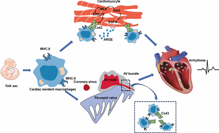 Cardiac resident macrophages in cardiovascular disease: from physiology ...